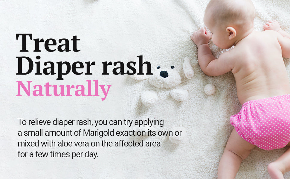 
                  
                    Treat diaper rash .. Naturally .. To relieve diaper rash, you can try applying a small amount of marigold exact on the affected area for a few times per day.
                  
                